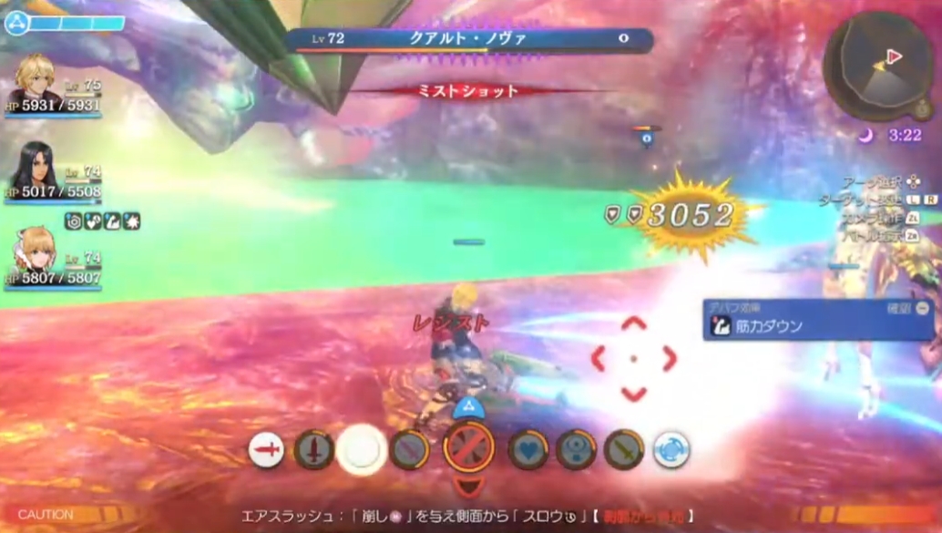 Review xenoblade definitive edition